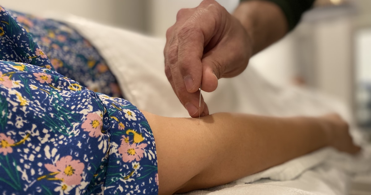 Sessão de acupuntura